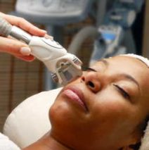 How long does it take for brown spots to fade after laser treatment?